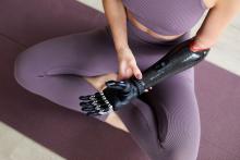 Woman with prosthetic arm